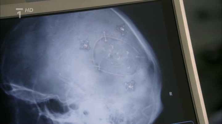 Tělo jako důkaz 01x03 Pomocná ruka avi